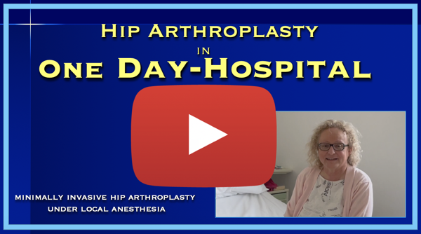 Hip Arthroplasty in one day Hospital Local anesthesia