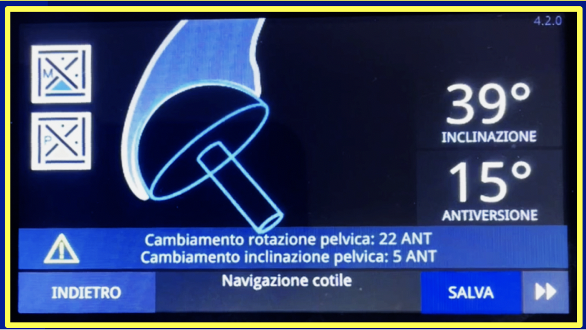 Navigazione anca 3